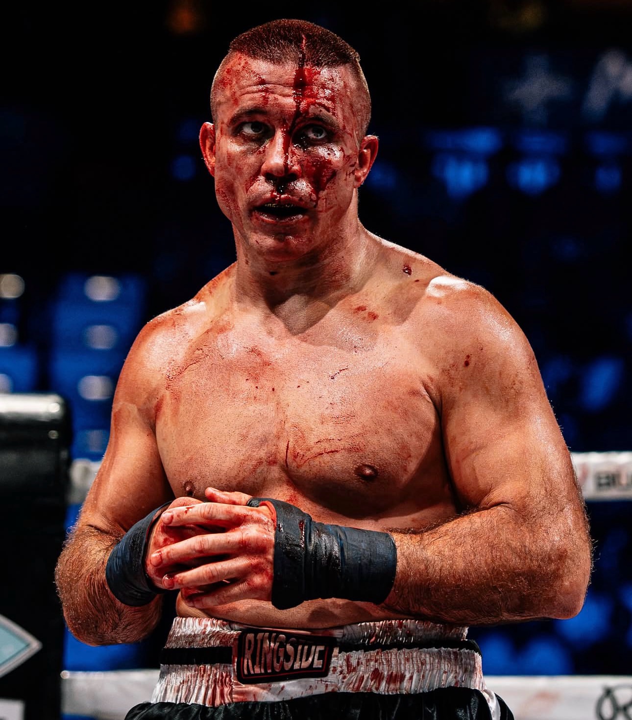 Cody Vidal after a bare-knuckle bout, blood on his face and hands wrapped